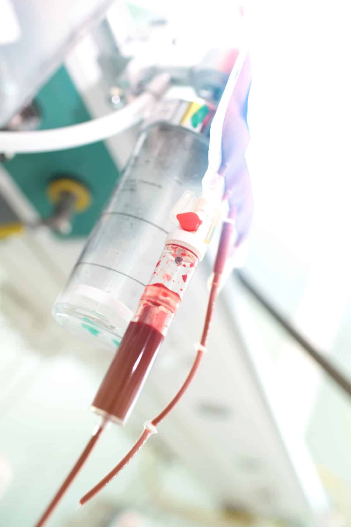 Stem Cell Infusion Therapy for Sexual Health